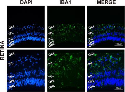 Isolation and Characterization of Primary Retinal Microglia From the Human Post-mortem Eyes for Future Studies of Ocular Diseases